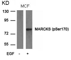 Polyclonal Antibody to MARCKS (phospho-Ser170)