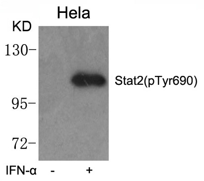 Polyclonal Antibody to Stat2 (phospho-Tyr690)