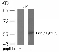 Polyclonal Antibody to Lck (phospho-Tyr505)