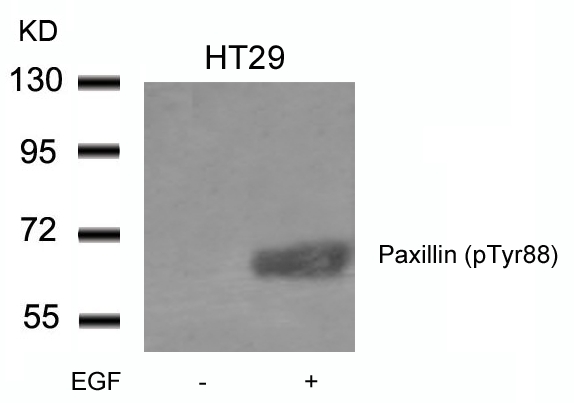 Polyclonal Antibody to Paxillin (phospho-Tyr88)