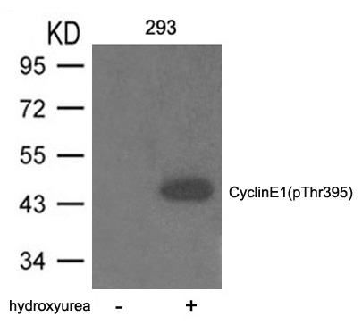 Polyclonal Antibody to Cyclin E1 (phospho-Thr395)