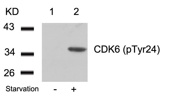 Polyclonal Antibody to CDK6 (phospho-Tyr24)