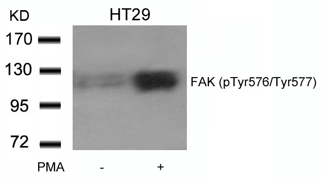 Polyclonal Antibody to FAK (phospho-Tyr576/Tyr577)