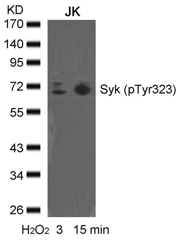 Polyclonal Antibody to syk (phospho-Tyr323)