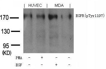 Polyclonal Antibody to EGFR (phospho-Tyr1197) Goat Polyclonal