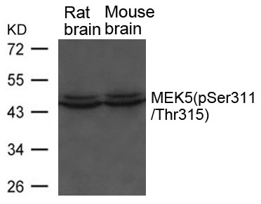 Polyclonal Antibody to MEK5(phospho-Ser311/ Thr315)