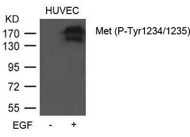 Polyclonal Antibody to Met (Phospho-Tyr1234/1235)