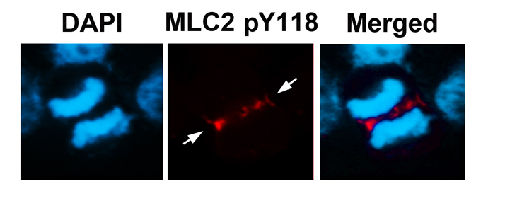 Polyclonal Antibody to MLC2 (Phospho-Tyr118)