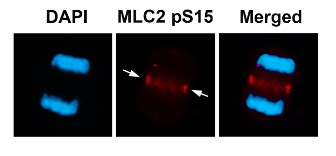 Polyclonal Antibody to MLC2 (Phospho-Ser15)