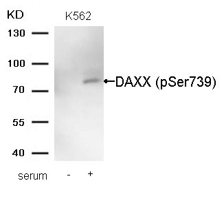 Polyclonal Antibody to DAXX (Phospho-Ser739)