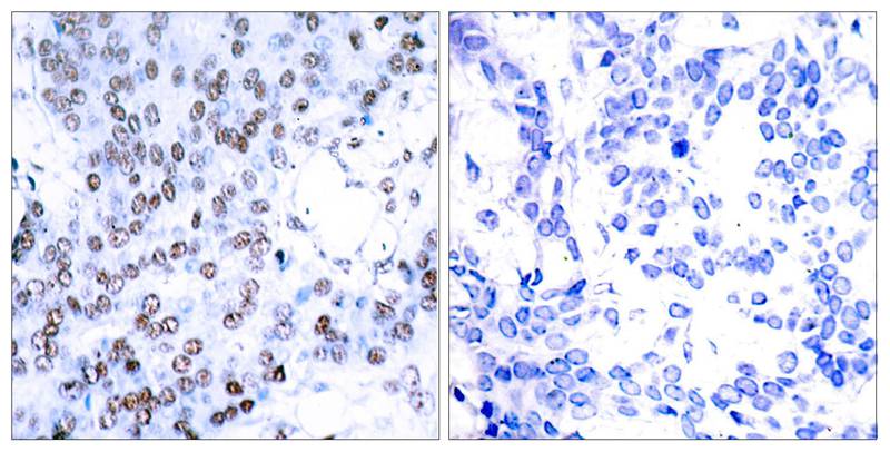 Polyclonal Antibody to JunB (Ab-79)