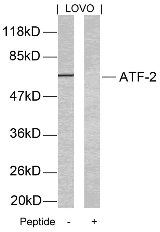 Polyclonal Antibody to ATF2 (Ab-69 or 51) (Discontinued)