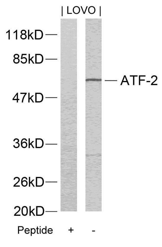 Polyclonal Antibody to ATF2 (Ab-73 or 55) (Discontinued)