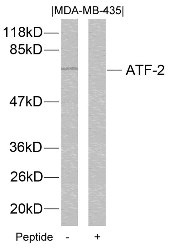 Polyclonal Antibody to ATF2 (Ab-112 or 94) (Discontinued)