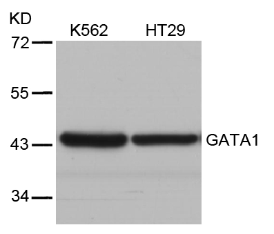 Polyclonal Antibody to GATA1 (Ab-310)