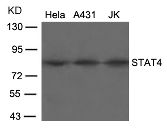 Polyclonal Antibody to STAT4 (Ab-693)