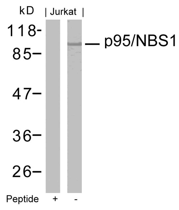 Polyclonal Antibody to p95/NBS1 (Ab-343)