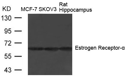 Polyclonal Antibody to Estrogen Receptor- Alpha (Ab-104)