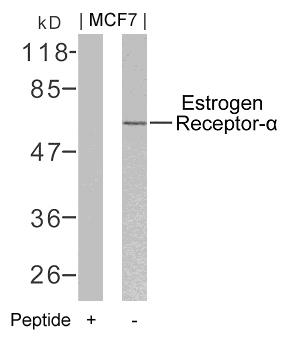 Polyclonal Antibody to Estrogen Receptor- Alpha (Ab-106)