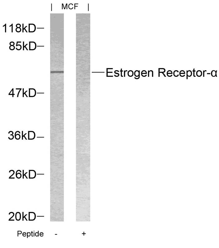 Polyclonal Antibody to Estrogen Receptor- Alpha (Ab-118)