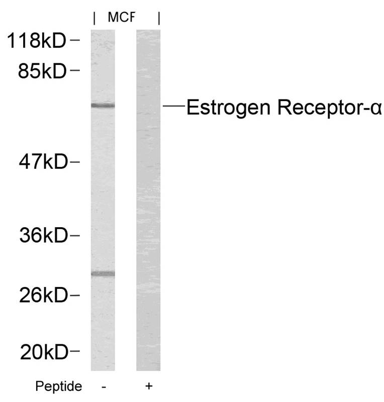 Polyclonal Antibody to Estrogen Receptor- Alpha (Ab-167)