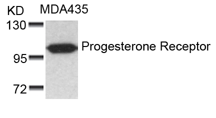 Polyclonal Antibody to Progesterone Receptor (Ab-190)