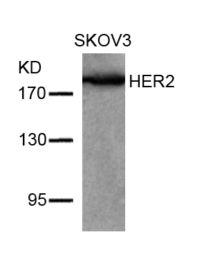 Polyclonal Antibody to HER2 (Ab-877)