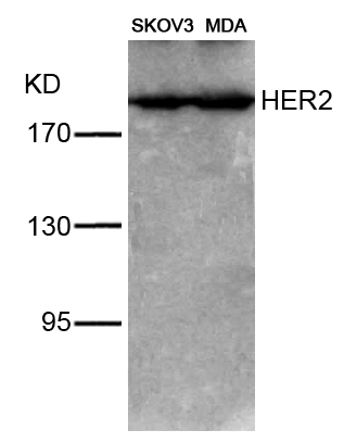 Polyclonal Antibody to HER2 (Ab-1221/1222) (Discontinued)