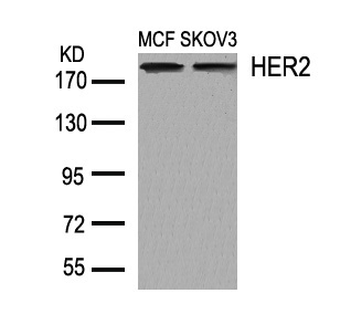 Polyclonal Antibody to HER2 (Ab-1248)