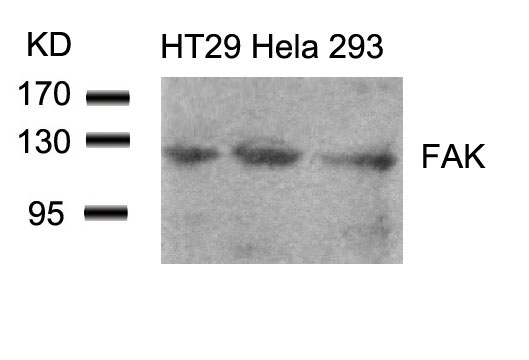 Polyclonal Antibody to FAK (Ab-861)