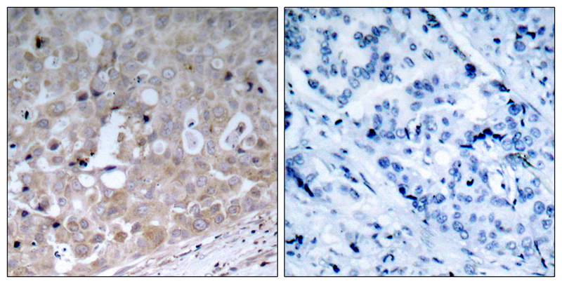 Polyclonal Antibody to VEGFR2 (Ab-1175)