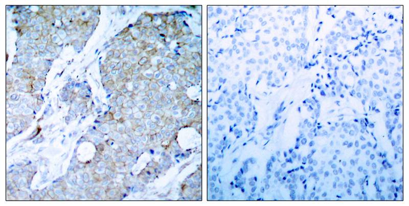 Polyclonal Antibody to VEGFR2 (Ab-1214)