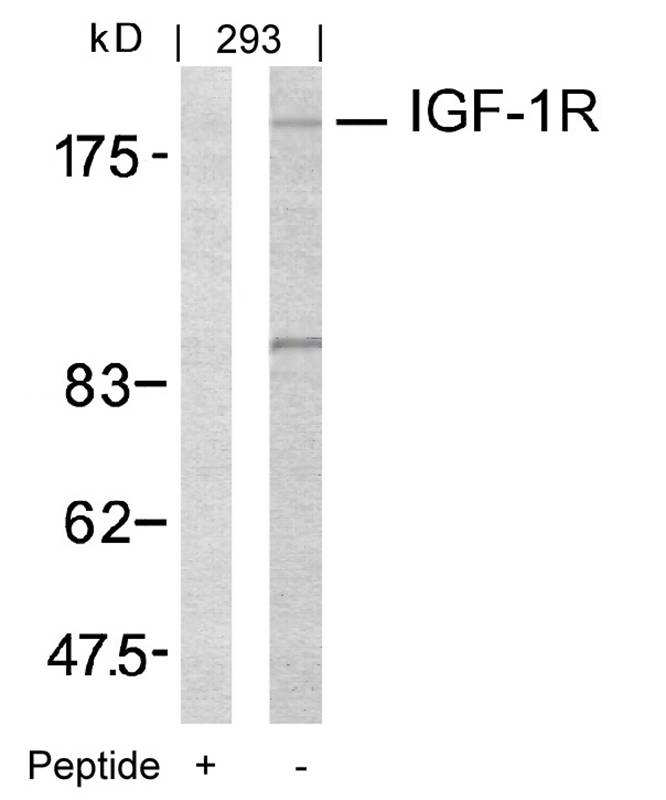 Polyclonal Antibody to IGF-1R (Ab-1161)