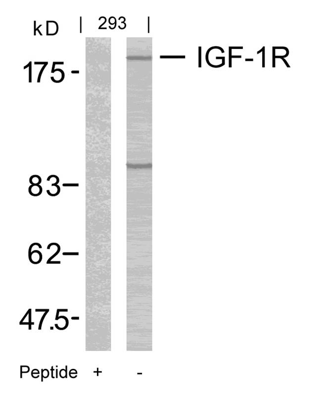 Polyclonal Antibody to IGF-1R (Ab-1165/1166)