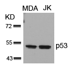 Polyclonal Antibody to p53 (Ab-15)