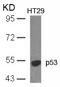 Polyclonal Antibody to p53 (Ab-18) (Discontinued)