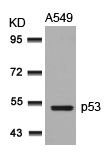 Polyclonal Antibody to p53 (Ab-315) (Discontinued)