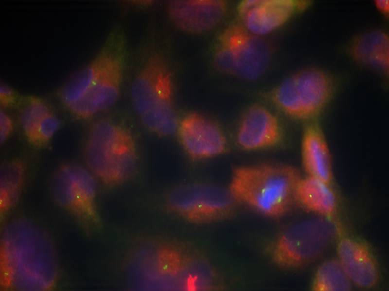 Polyclonal Antibody to Tau (Ab-356)