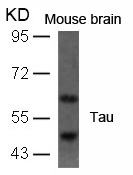 Polyclonal Antibody to Tau (Ab-396)