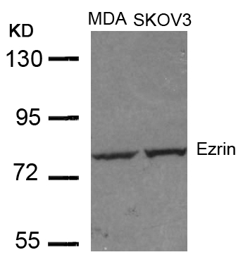 Polyclonal Antibody to Ezrin (Ab-353)