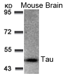 Polyclonal Antibody to Tau (Ab-205)