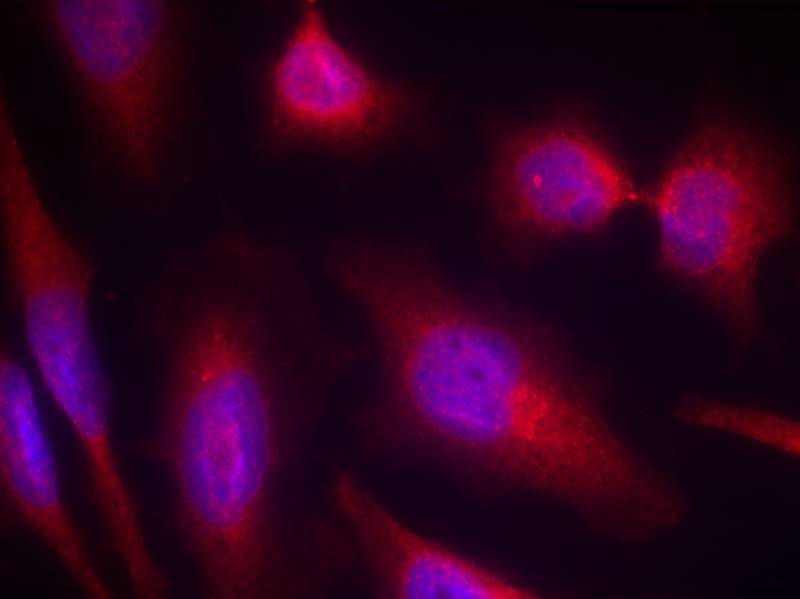 Polyclonal Antibody to Tau (Ab-214)