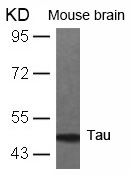 Polyclonal Antibody to Tau (Ab-231)