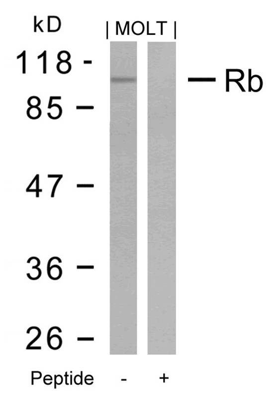 Polyclonal Antibody to Rb (Ab-795)