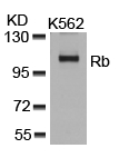 Polyclonal Antibody to Rb (Ab-807)