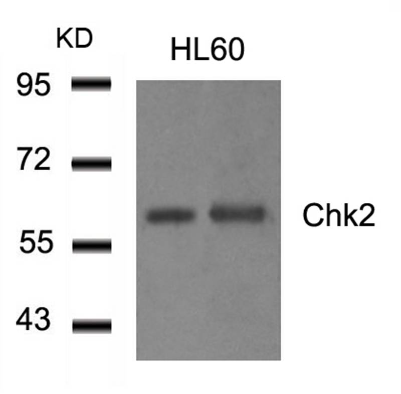 Polyclonal Antibody to Chk2 (Ab-516)