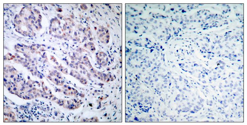 Polyclonal Antibody to TYK2 (Ab-1054)