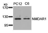 Polyclonal Antibody to NMDAR1 (Ab-896)