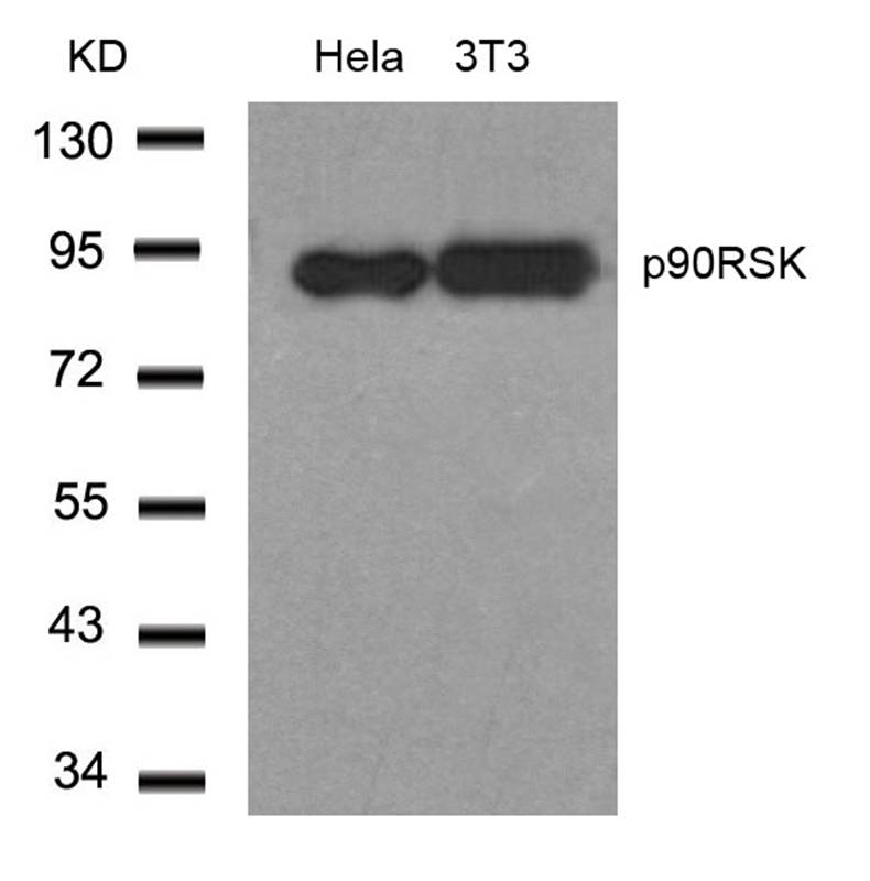 Polyclonal Antibody to p90RSK (Ab-348)