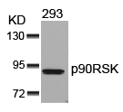 Polyclonal Antibody to p90RSK (Ab-352)